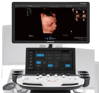 P11 Elite 4D Renkli Doppler USG