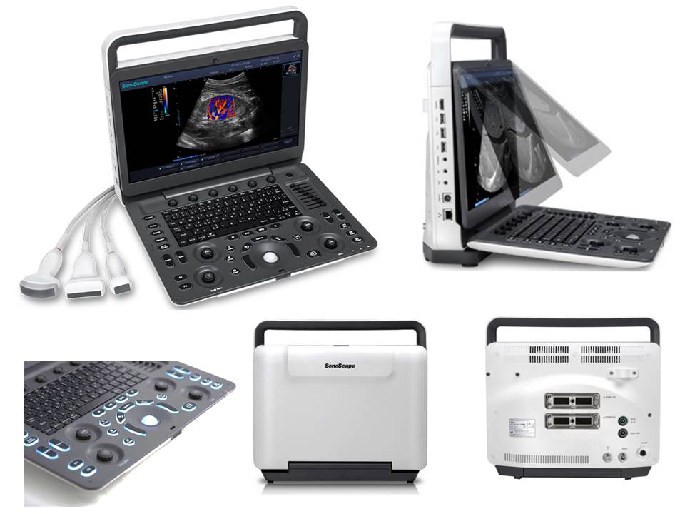 E Serisi Taşınabilir Renkli Doppler USG