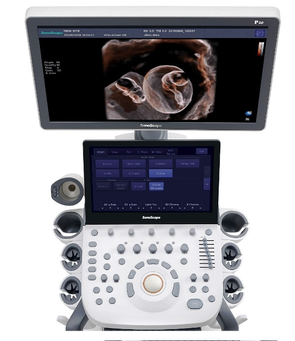 P20 Elite Renkli Doppler USG